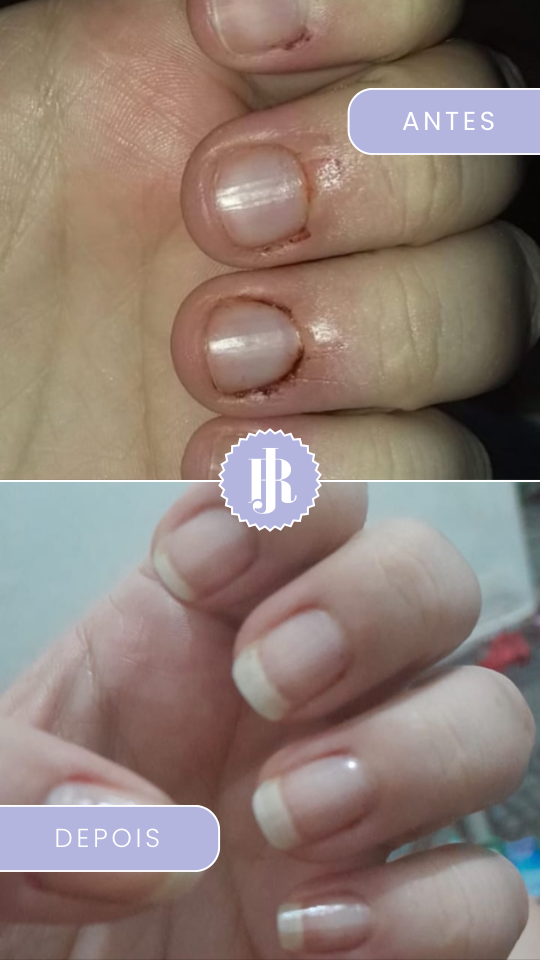 como fazer fortalecedor de unha