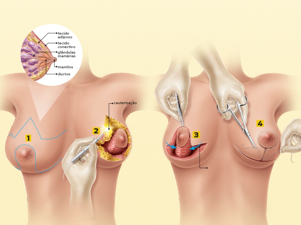 Guia Completo: Documentos Necessários para Cirurgia no SUS