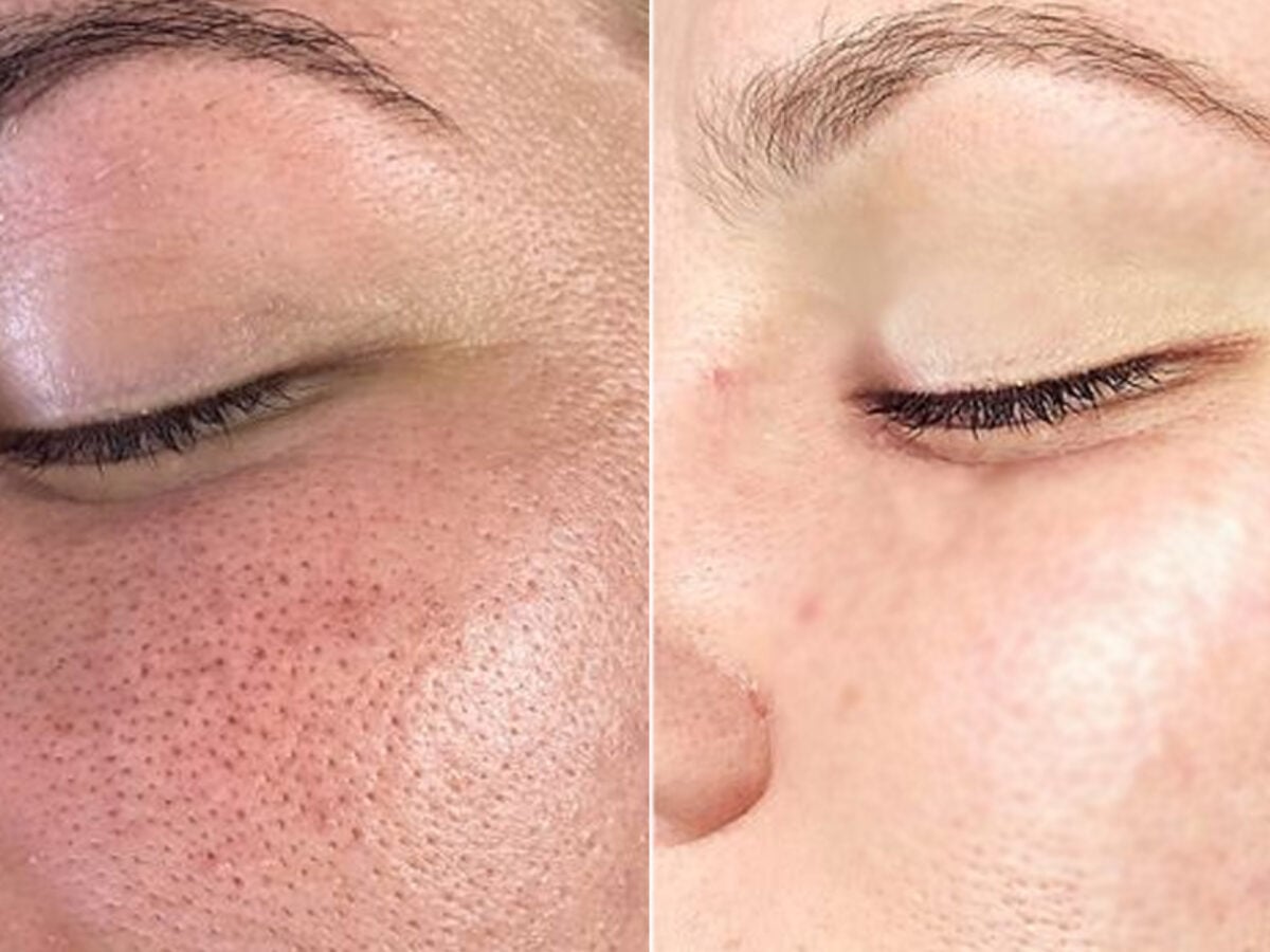 como fechar os poros do rosto antes da maquiagem