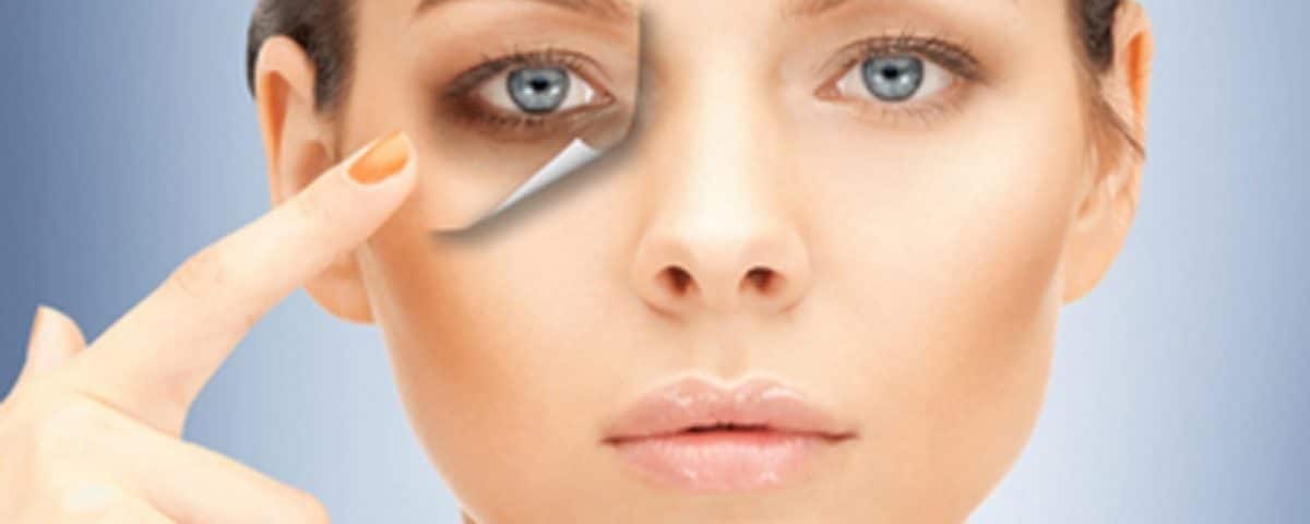 como clarear olheiras