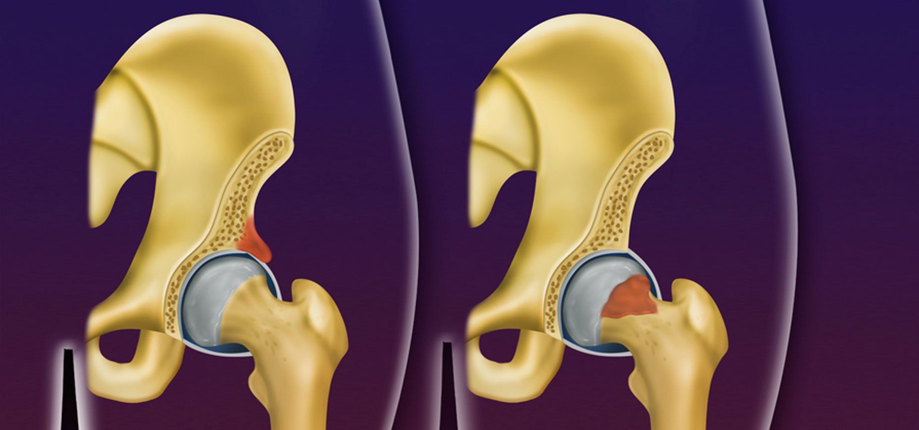 dor na região inguinal feminina lado direito
