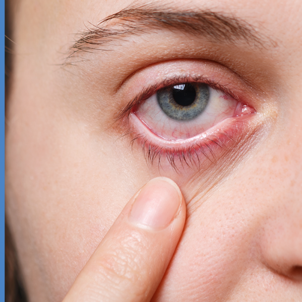 Guia Completo: Como Escolher o Demaquilante Ideal para Seus Olhos