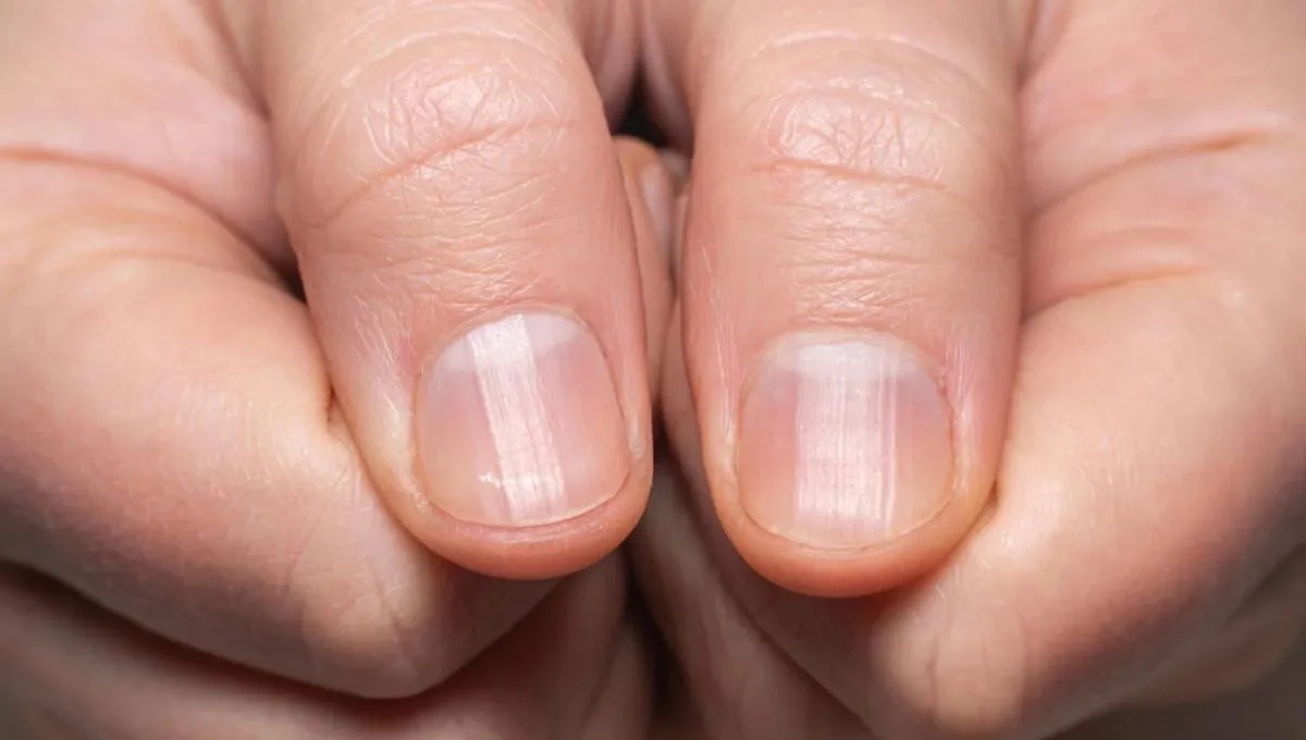 A importância da dermatoscopia no diagnóstico de lesões ungueais