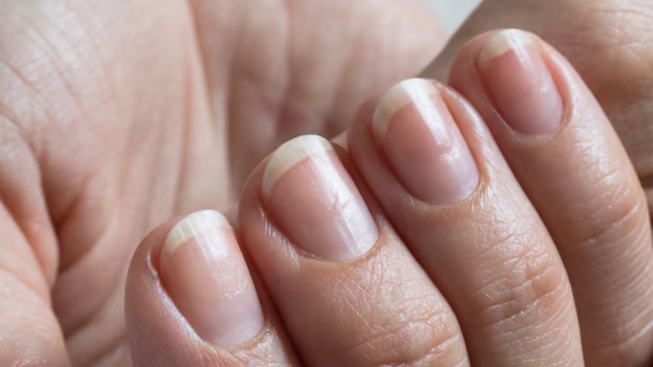Cuidados com as unhas para evitar traumas e listras