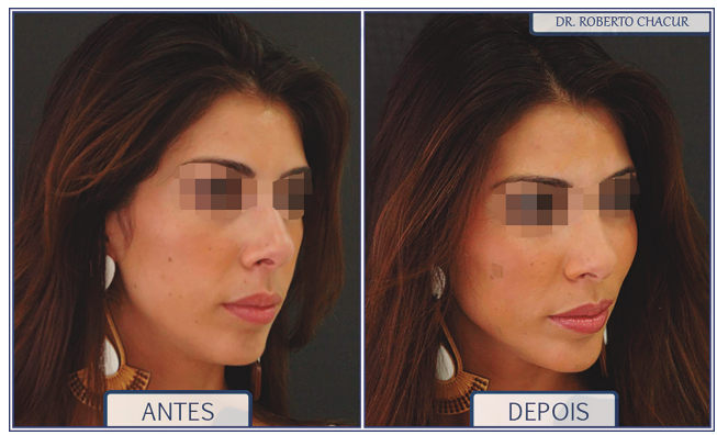 Maquiagem para Realçar as Maçãs do Rosto: Técnicas de Iluminador e Contorno