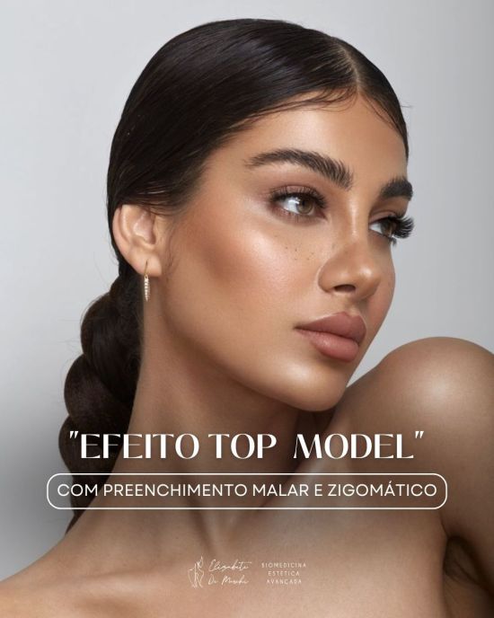 5 ideias de títulos