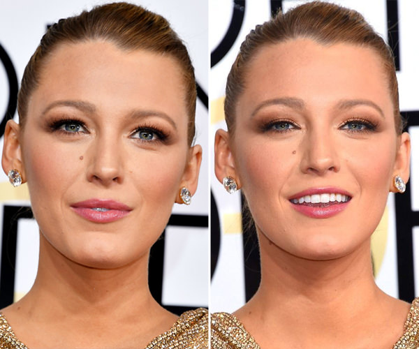 Produtos Essenciais para um Look Blake Lively Acessível: Opções Nacionais
