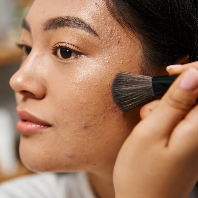 maquiagem para pele com acne