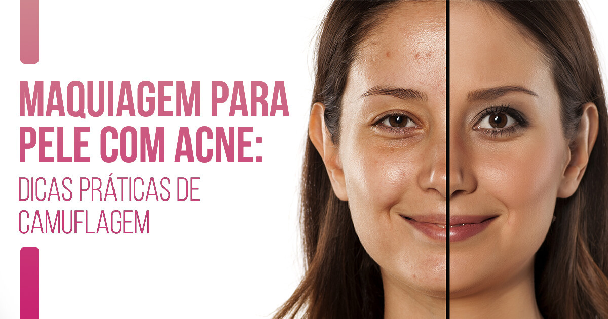 Guia completo: Como escolher o melhor sabonete facial para pele acneica