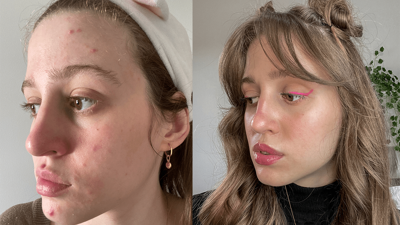 Os melhores hidratantes leves para usar antes da maquiagem em pele oleosa