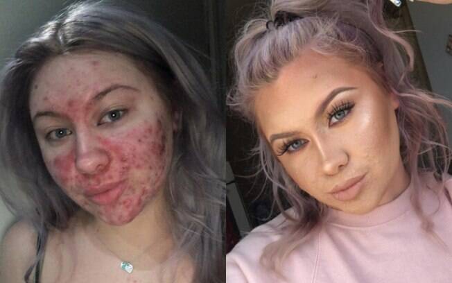 Como identificar ingredientes comedogênicos em seus produtos de maquiagem