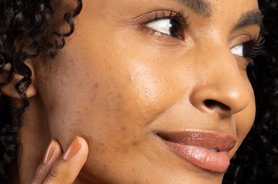 5 ideias de títulos