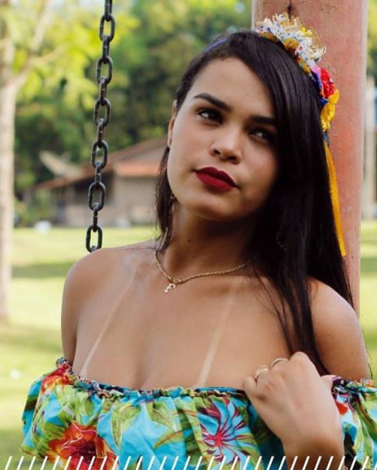 Biquíni de Fita: História