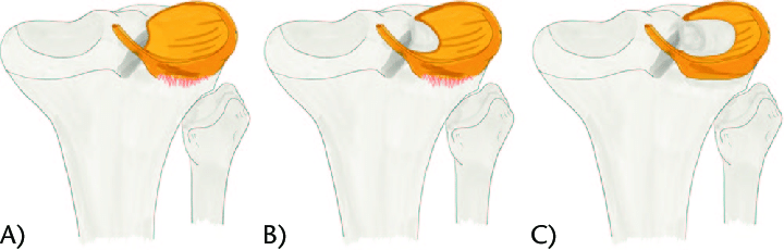 O Legado de Meninices da Vida: Um Olhar Sobre o Conteúdo que Marcou Época
