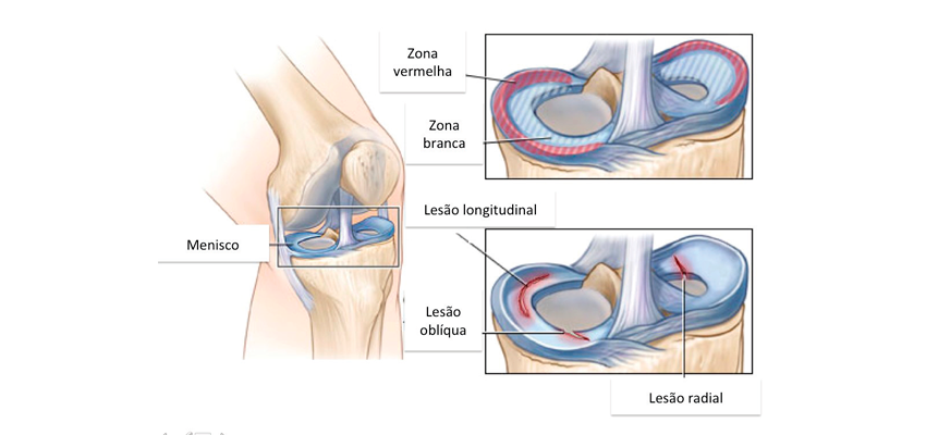 A Influência dos Blogs de Moda nos Anos 2010: O Caso Meninices da Vida