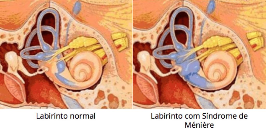 Relembrando os Temas de Meninices da Vida: Moda