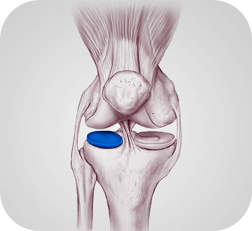 O Legado de Meninices da Vida: Um Olhar Sobre o Conteúdo que Marcou Época
