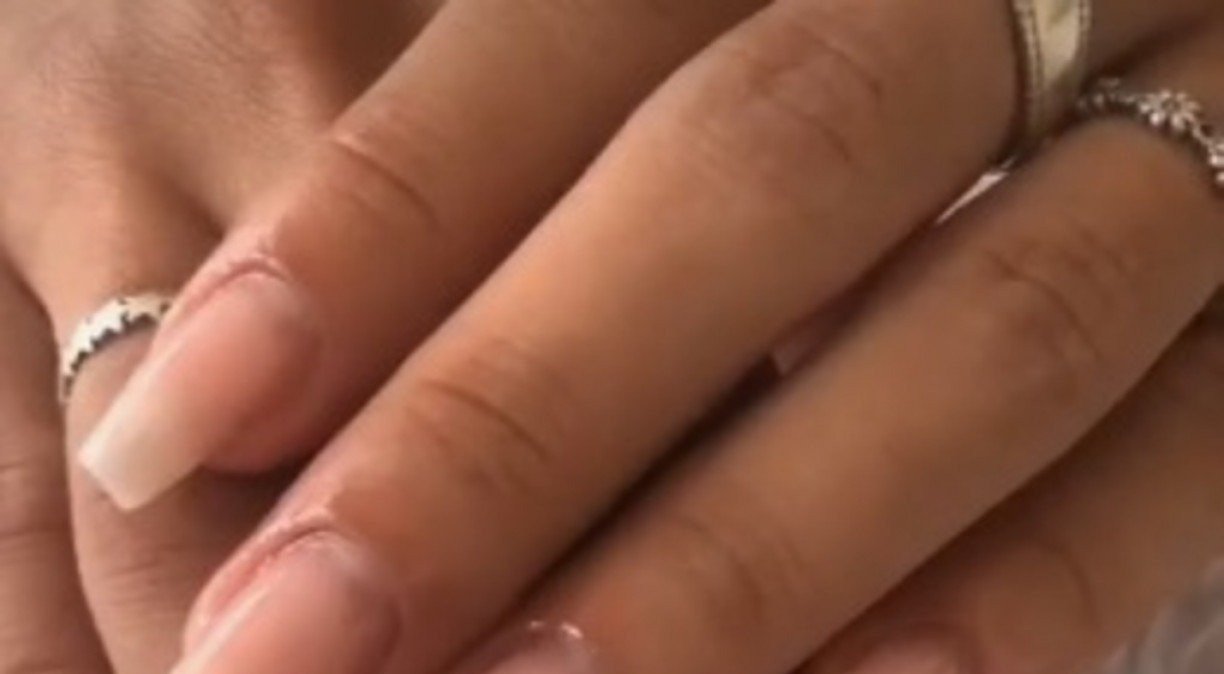 minhas unhas não crescem