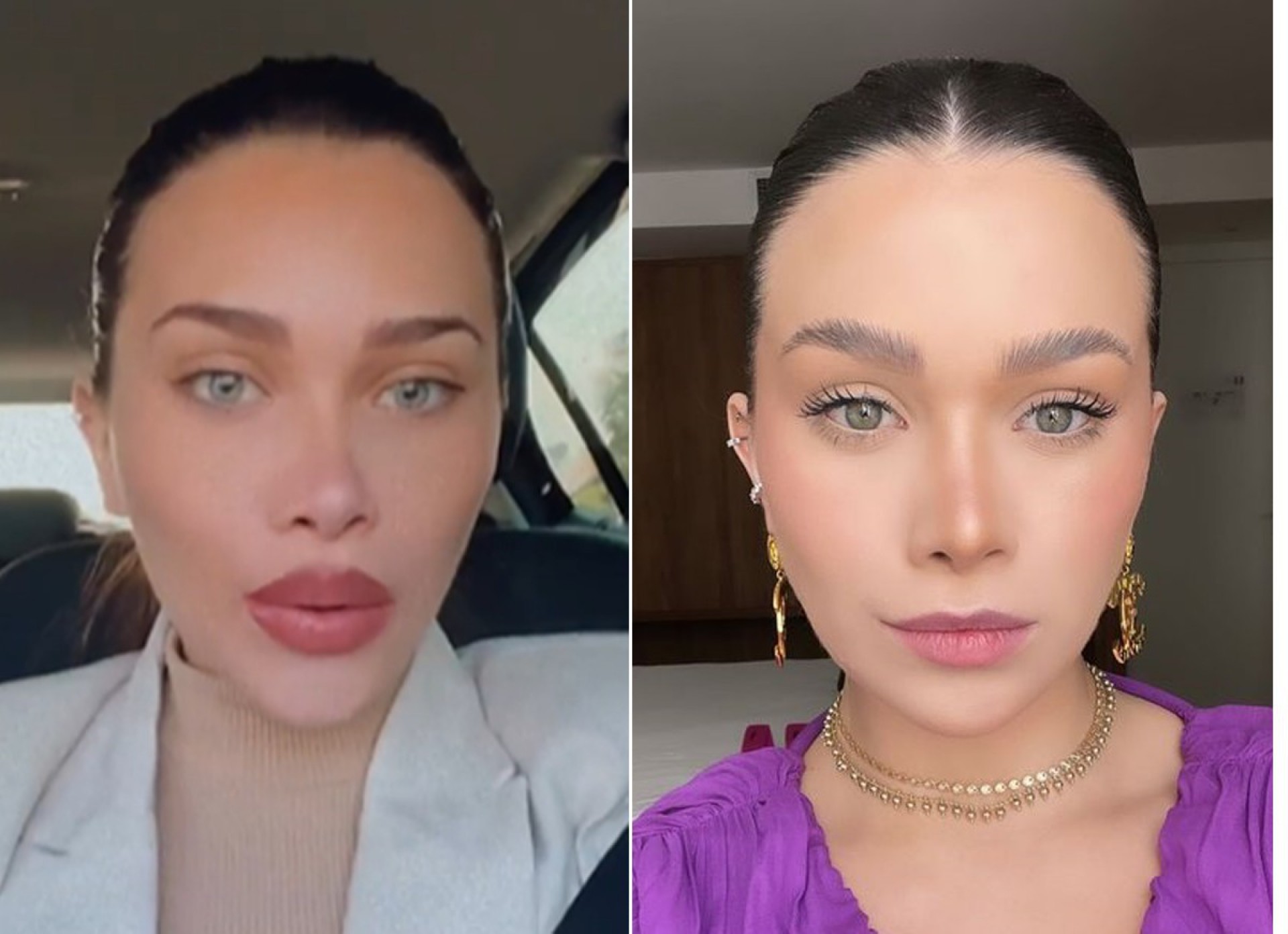 5 ideias de títulos:
1. Guia Completo: Tipos de Modelos de Boca e Suas Aplicações
2. Modelos de Boca: Da Odontologia à Arte - Um Guia Essencial
3. Como Escolher o Modelo de Boca Ideal para Suas Necessidades
4. A Importância dos Modelos de Boca no Ensino e na Prática Clínica
5. Explorando a Anatomia e a Expressão com Modelos de Boca