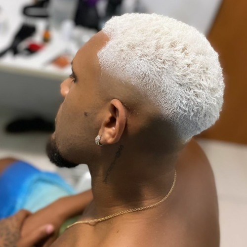 descoloração intensa