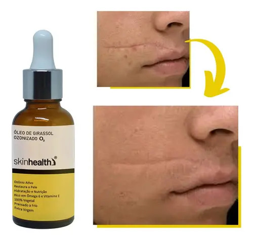 oleo de girassol pele