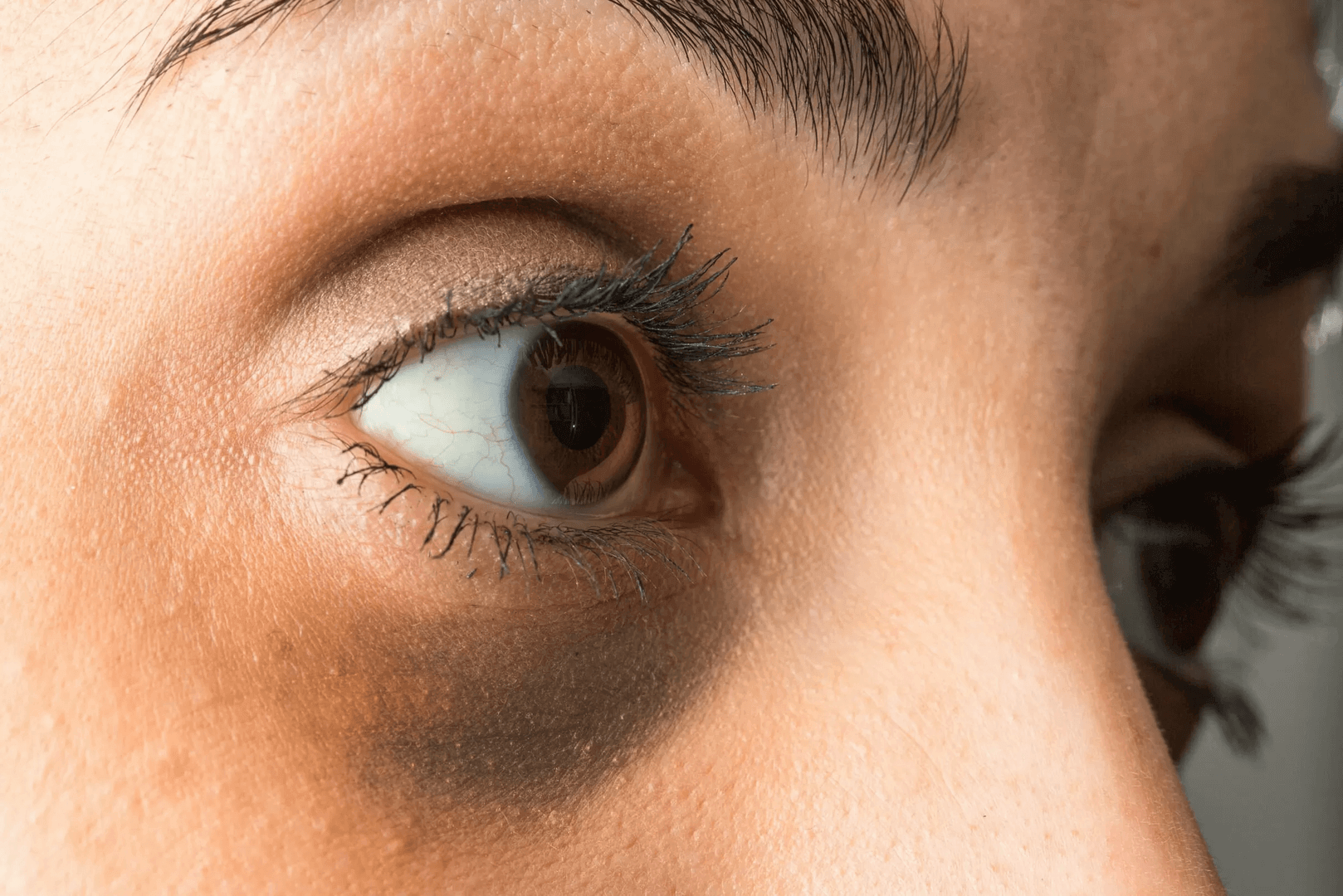 rotina skincare olheiras