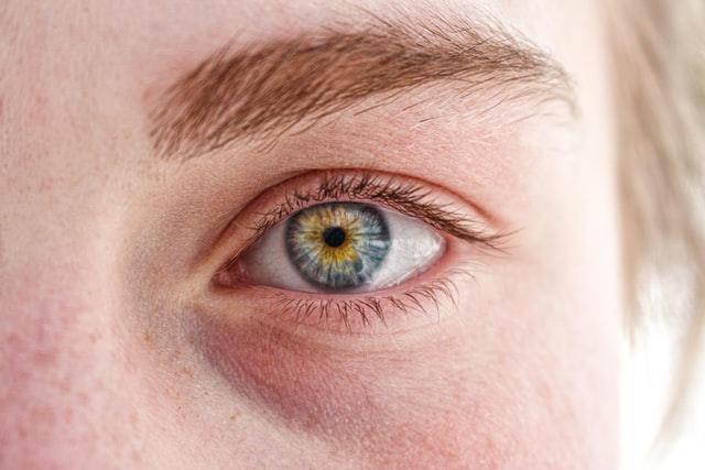 sérum para olheiras