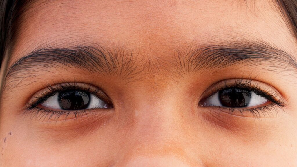 Mito ou Verdade: A Biologia por Trás dos Olhos 'Pretos'