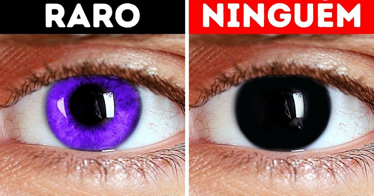 Olhos Castanhos Muito Escuros: Entenda a Concentração de Melanina