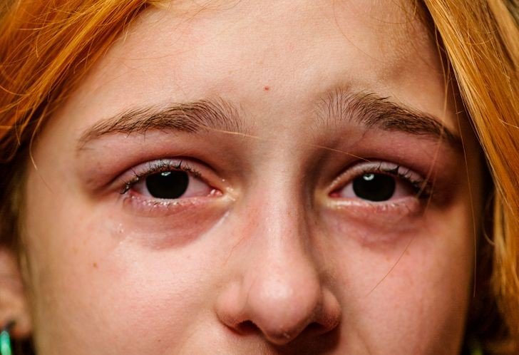 Olhos Pretos na Cultura Pop: De Supernatural a Eddsworld