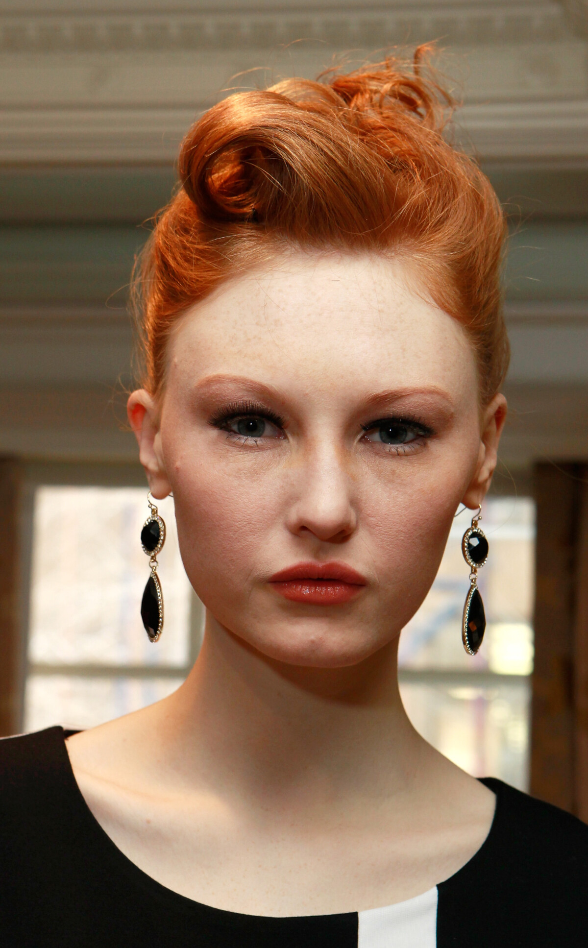 Enoftalmia: Quando o Afundamento dos Olhos Requer Atenção Médica