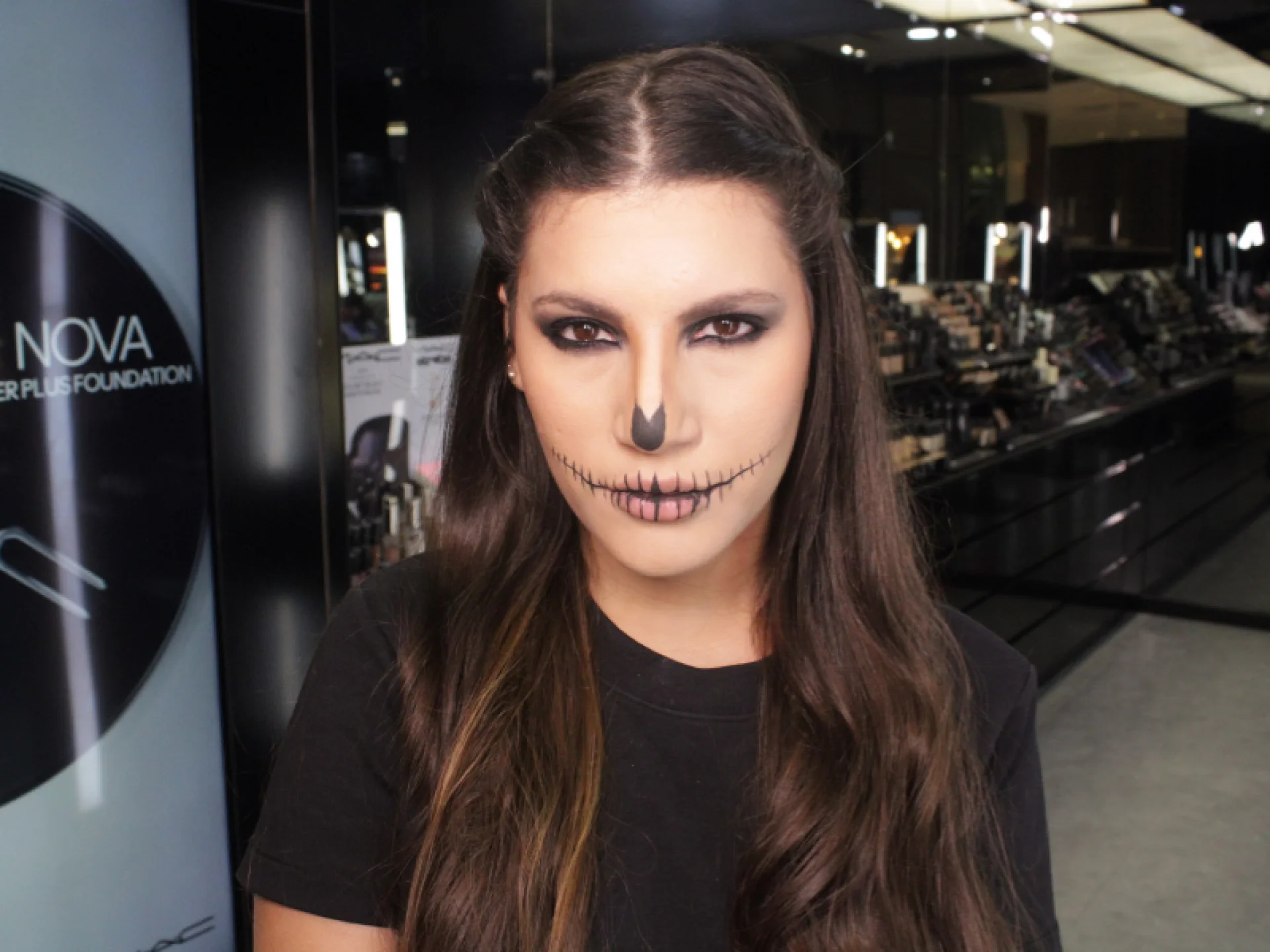 Tratamentos Estéticos para Olheiras: Laser