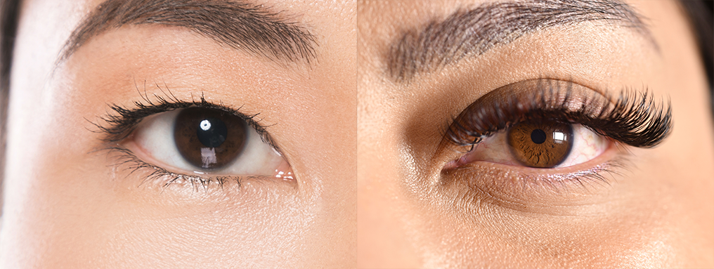 Preenchimento e Peelings