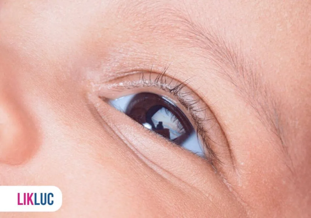 Quando a Olheira Escura é Sinal de Alerta? Saiba os Sinais Graves