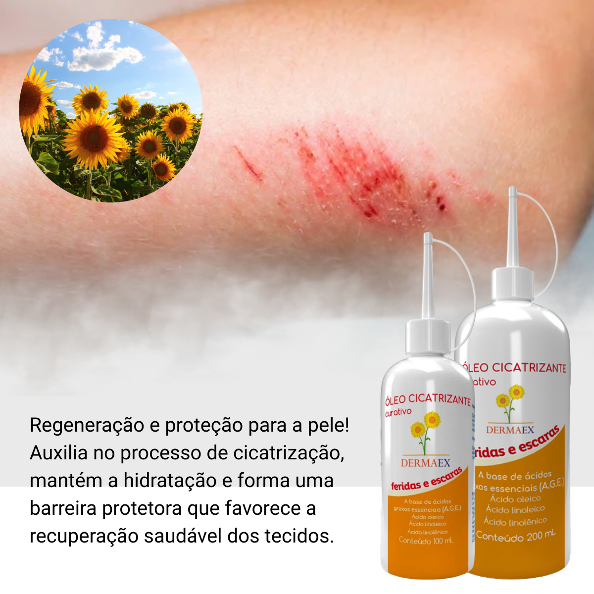 Dermaex e Outros Óleos de Girassol: Soluções Cicatrizantes para Pele