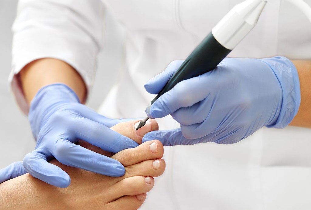 Pé diabético: a importância do acompanhamento podológico