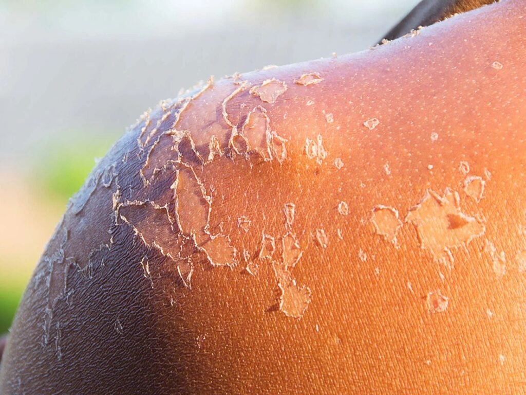 quando passo base minha pele descasca