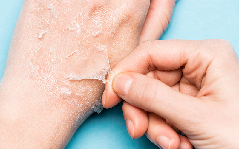 Os Melhores Hidratantes para Usar Antes da Base e Evitar o Craquelamento