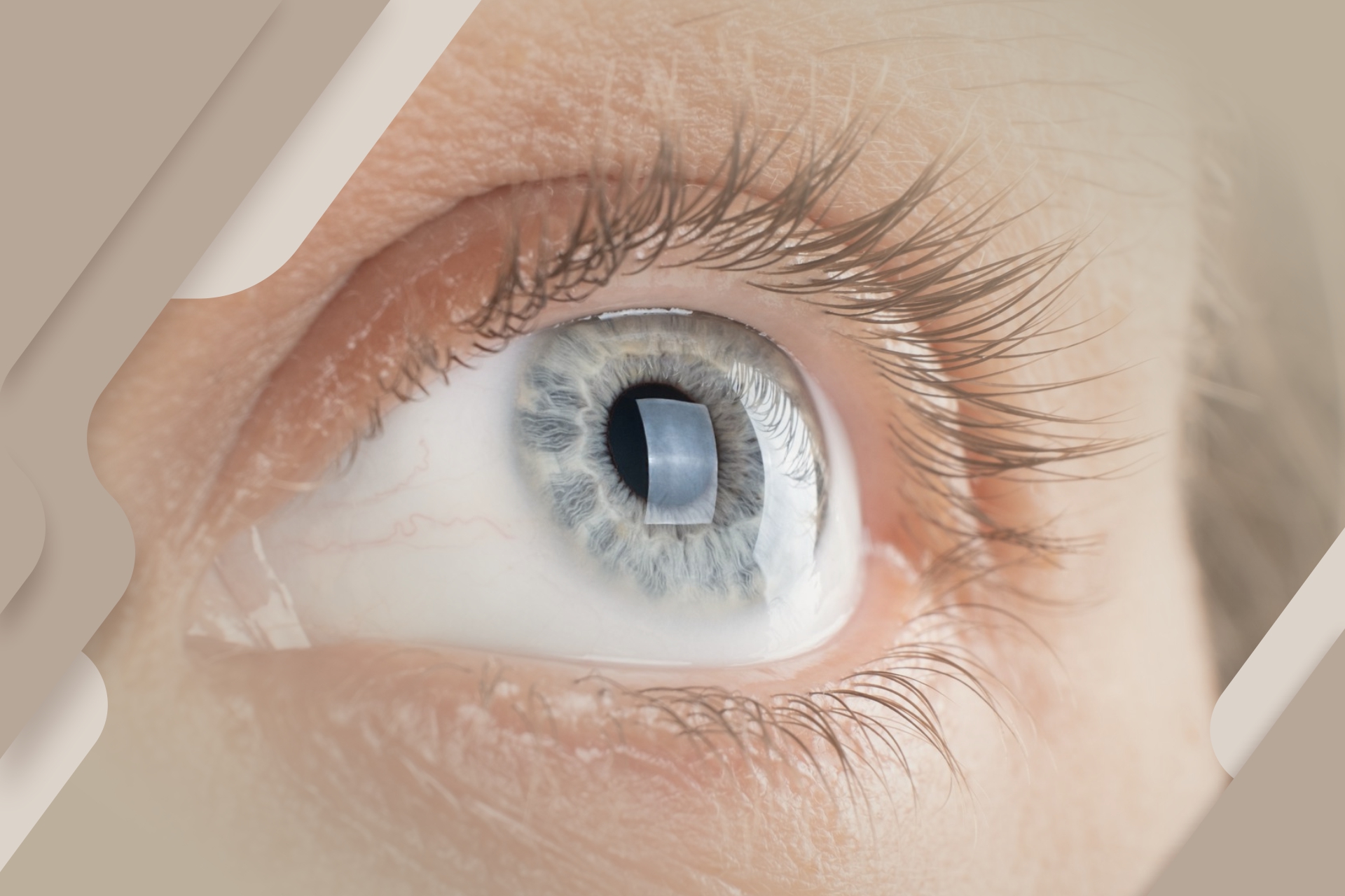 Extensão de Cílios Causa Queda? Mitos e Verdades Sobre o Procedimento