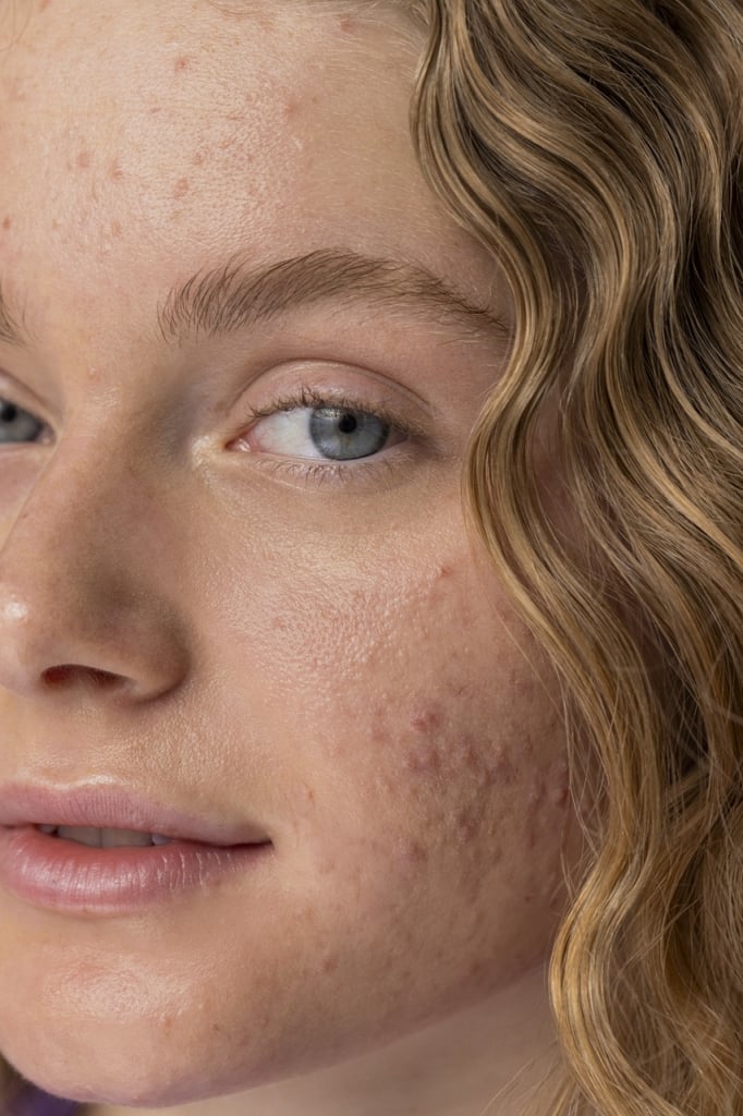 Quando Procurar um Médico para Queda de Cílios: Sinais de Alerta