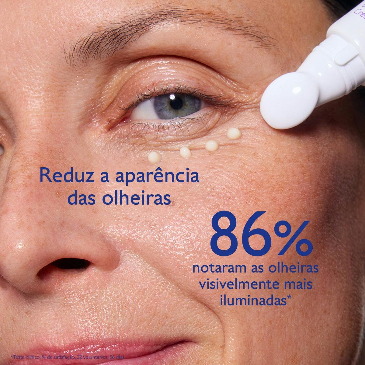 redução de olheiras