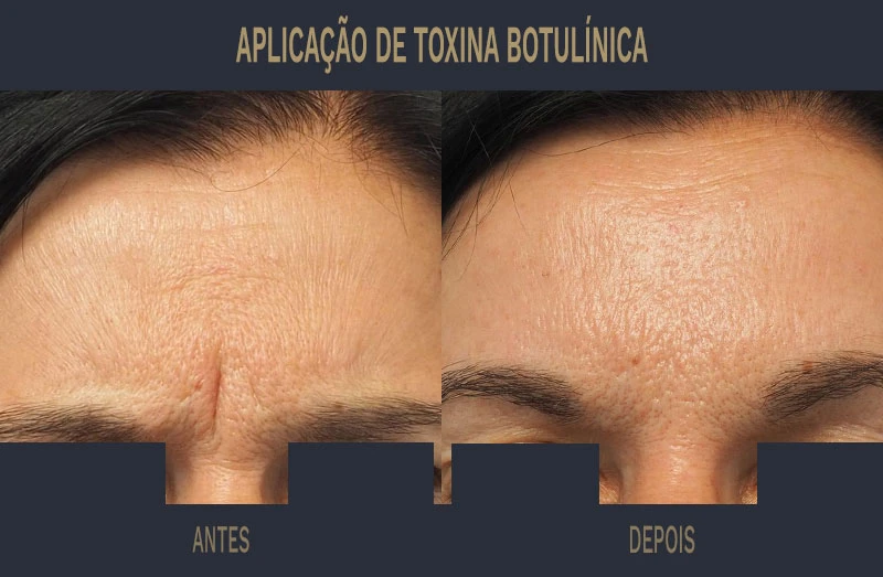 Guia Completo de Skincare Antirrugas: Ingredientes Essenciais