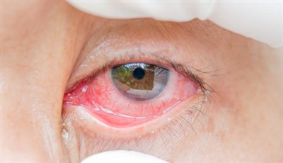 Sabão no olho do seu filho: O que fazer e quando procurar ajuda médica