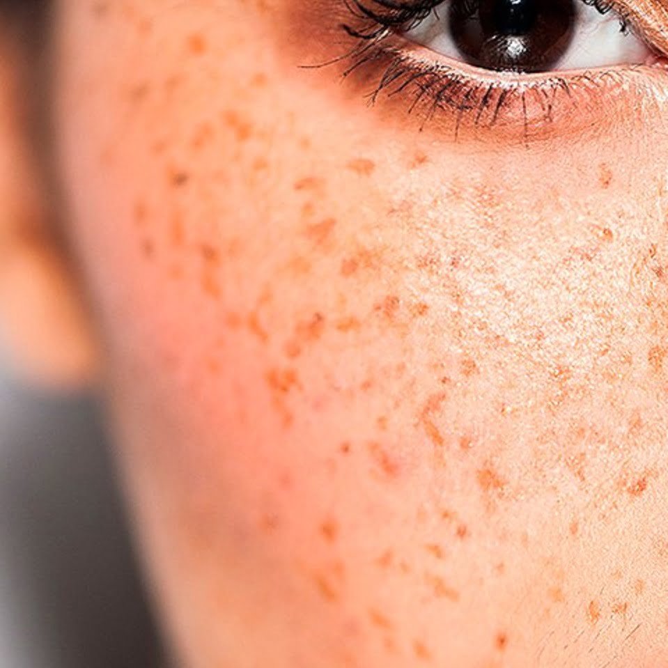 maquiagem para sardas