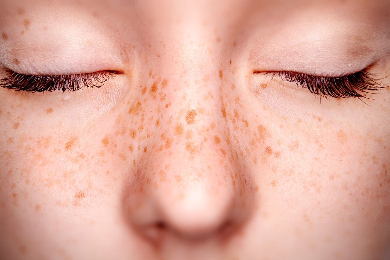 maquiagem para sardas