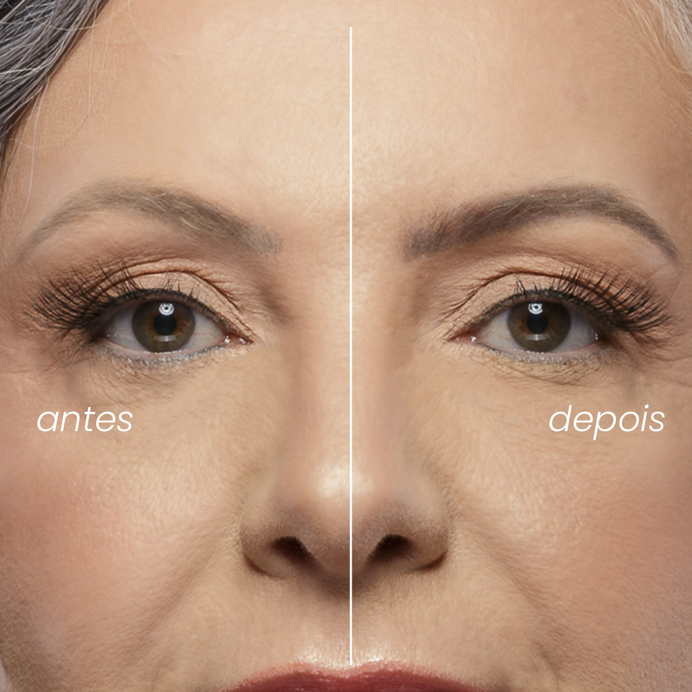 Colorimetria na Micropigmentação: Entenda a Neutralização de Tons Indesejados