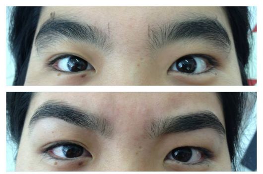 Nanoblading vs. Microblading: Qual a Melhor Técnica para Sobrancelhas Asiáticas?