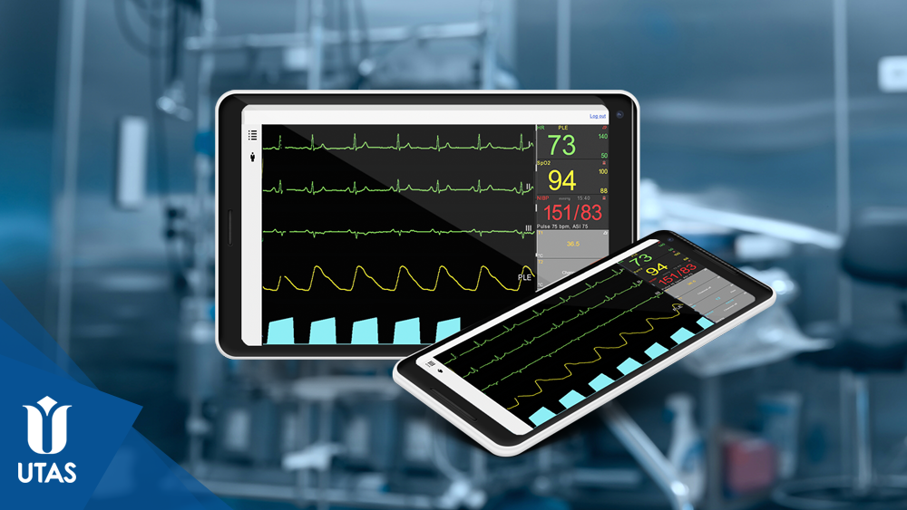 Como escolher a memória RAM ideal para seu tablet