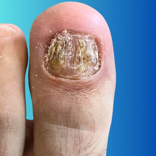 prevenção e tratamentos eficazes