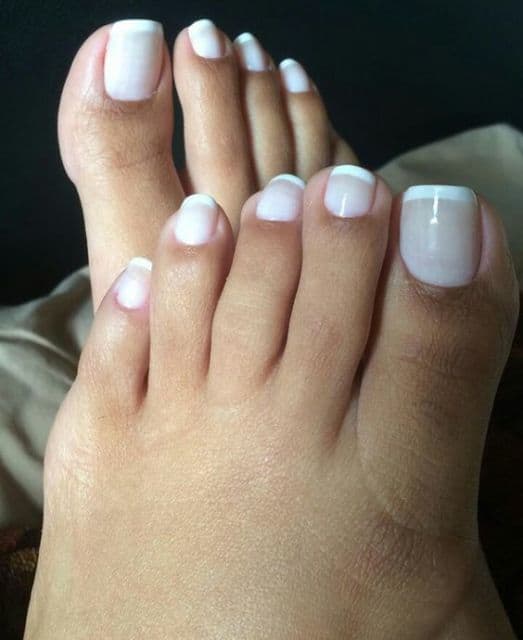 Micose de Unha: Sintomas